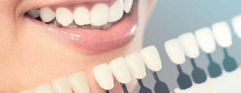 Cosmetic Dentistry